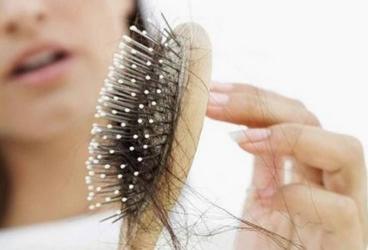 女性脱发怎么办：针对不同原因采取有效措施