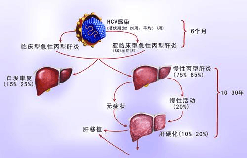 HCV抗体阳性：丙型肝炎的感染、症状与治疗方法