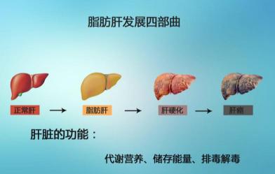 轻度脂肪肝的治疗：日常调理与病因深度解析